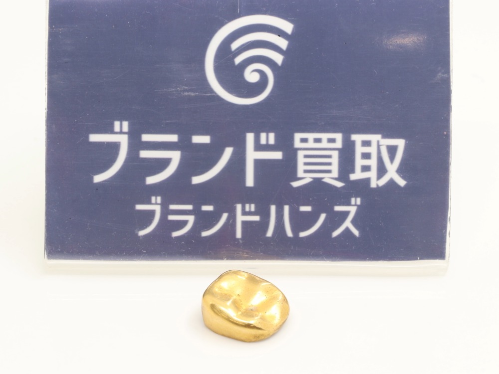 K10の金歯全体