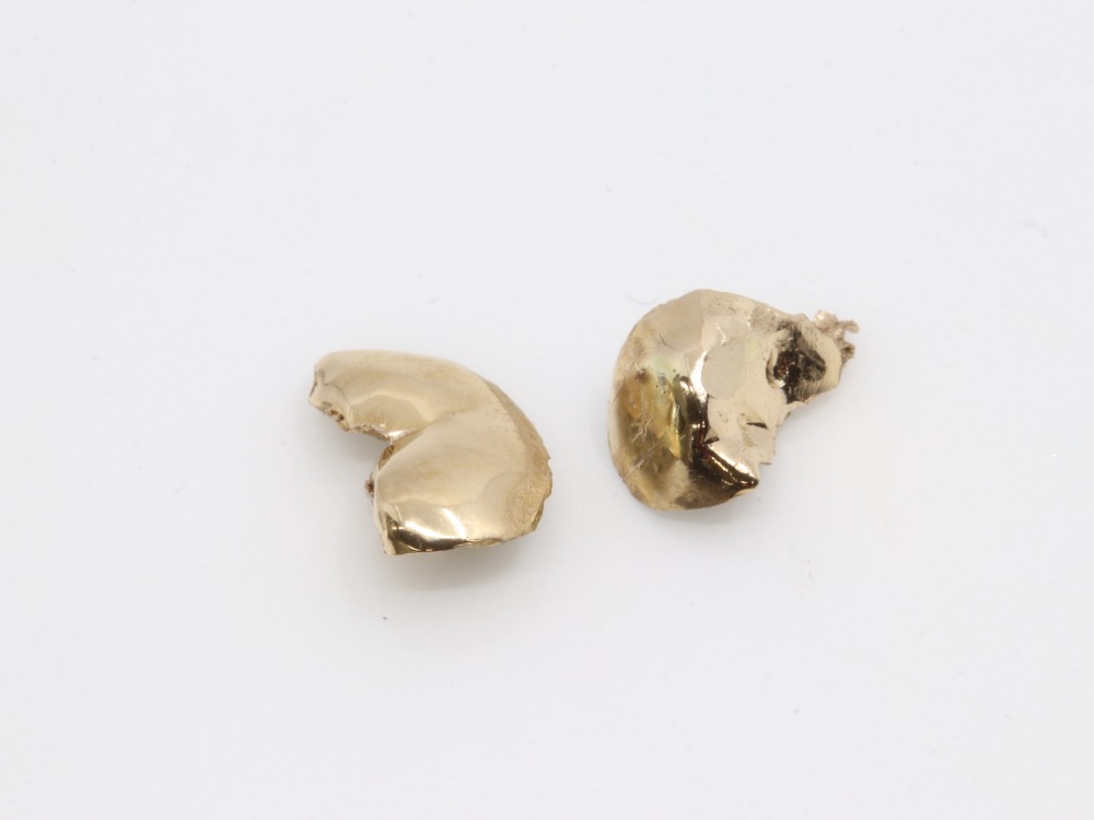 K14の金歯アップ