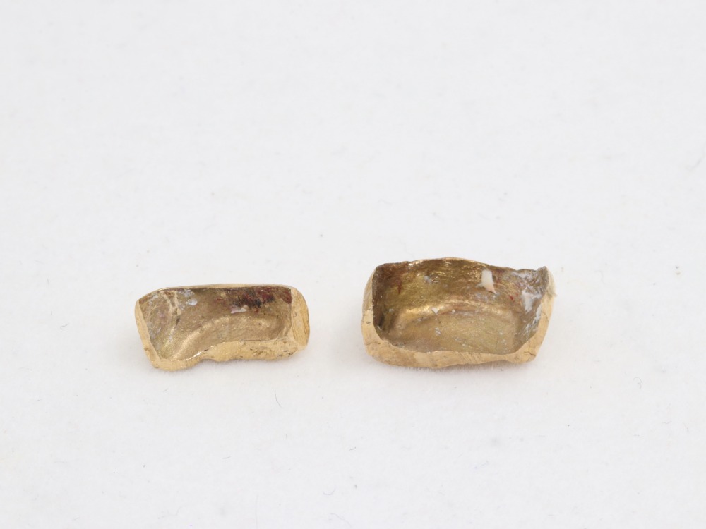 K14の含有率の金歯裏