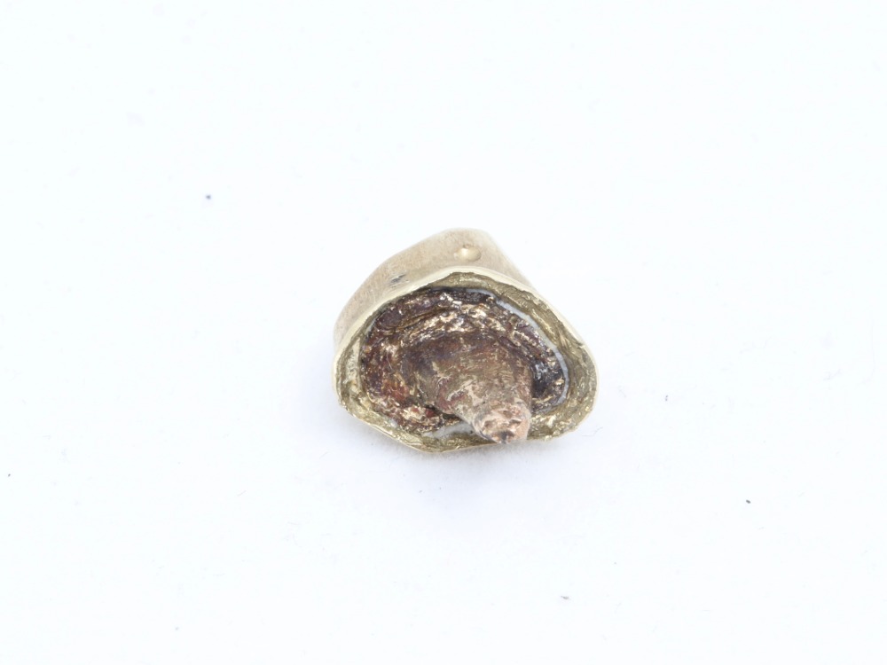 詰め物入りの金歯内