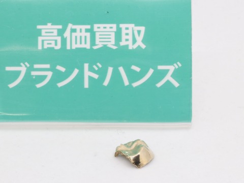 金歯
