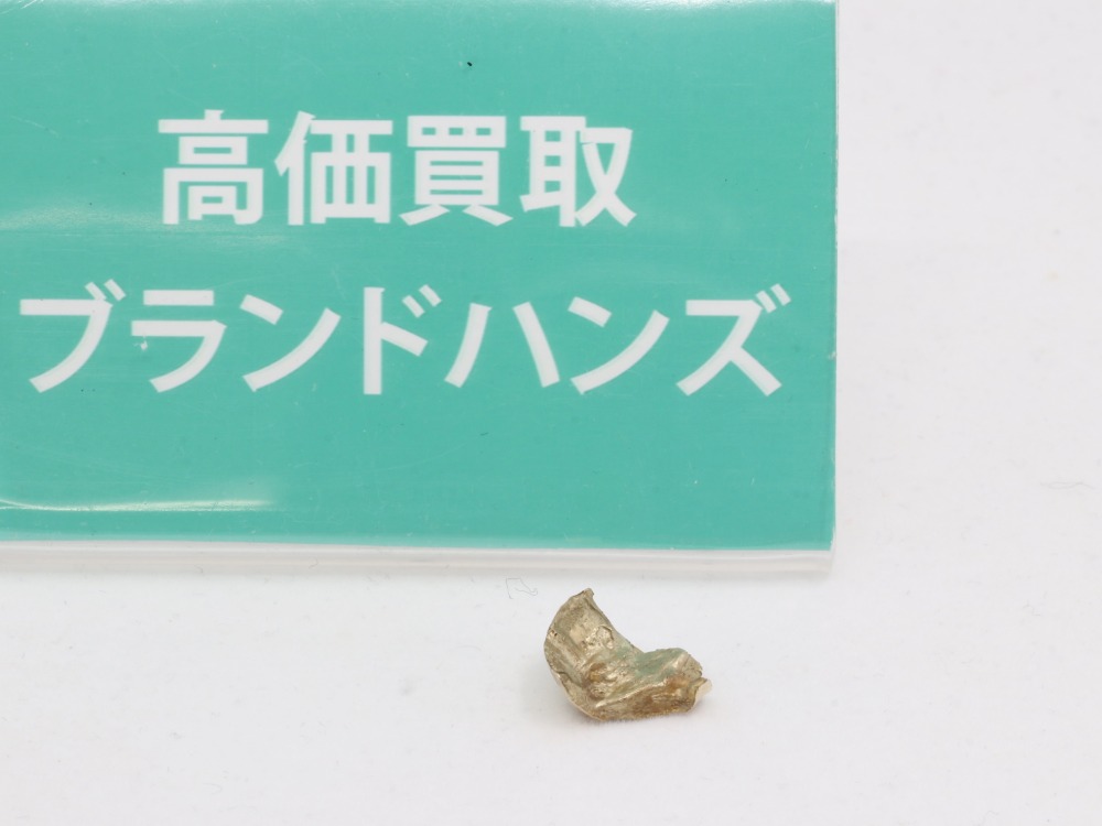金歯横